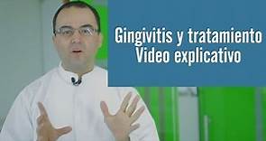 Gingivitis tratamiento | Juan Salgado | Video explicativo