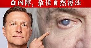 預防白內障的11個原因, 最佳自然療法,柏格醫生 Dr Berg