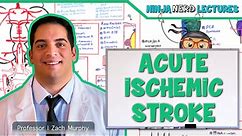 Acute Ischemic Stroke: Etiology, Pathophysiology, Clinical Features, Diagnostics, Treatment