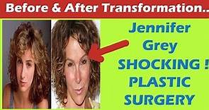 Jennifer Grey Plastic Surgery Before and After Full HD