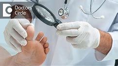 How long will it take a Comminuted Toe Fracture to heal? - Dr. Mohan M R