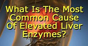What Is The Most Common Cause Of Elevated Liver Enzymes?