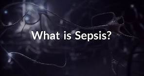 What is Sepsis? (Life-threatening Infection)