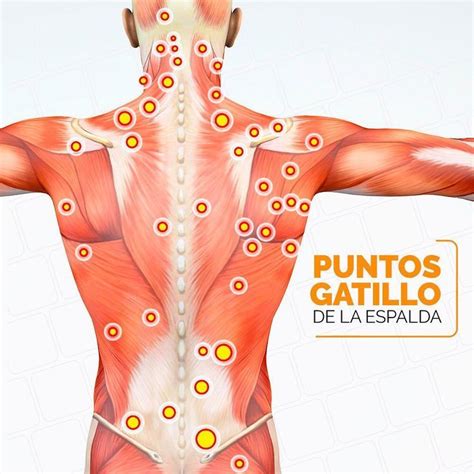 Gatillo