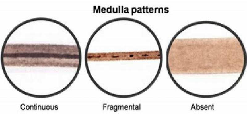 Absent Medulla Pattern