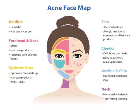 Acne Chart Women