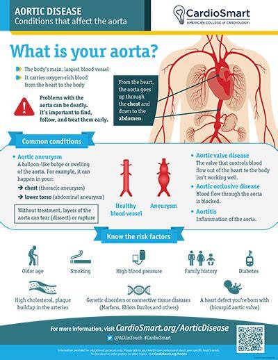 Aorta Diseases