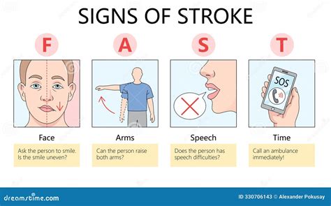 Arms Stroke