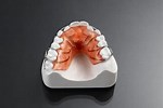 Articles On Removable Orthodontic Appliance