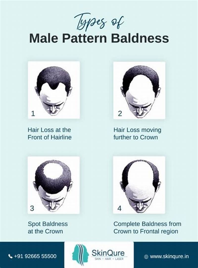 Baldness Pattern Types