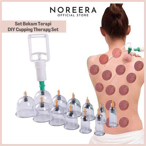 Bekam Cupping