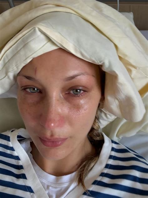 Bella Hadid sakit