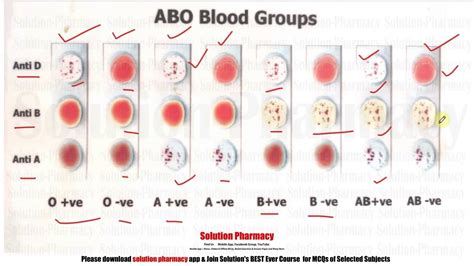 Blood Group Test Chart