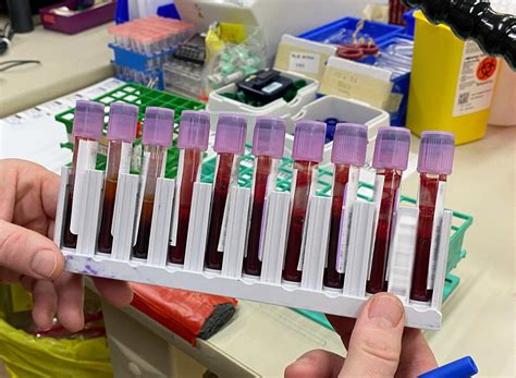 Blood sample