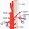 Bronchial Artery