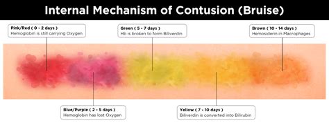Bruising Color Chart