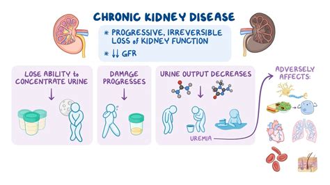 Komponen CKD
