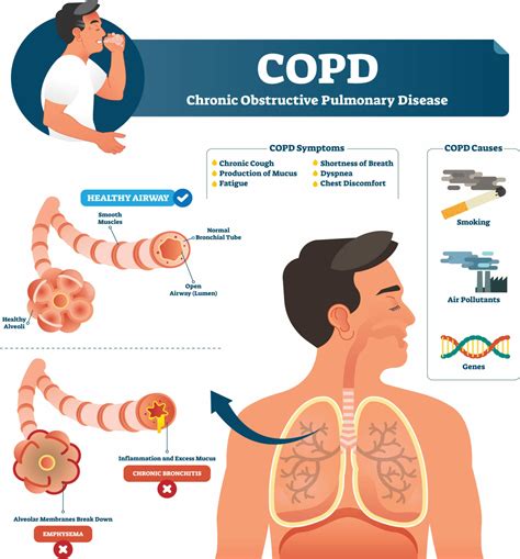 COPD Chronic