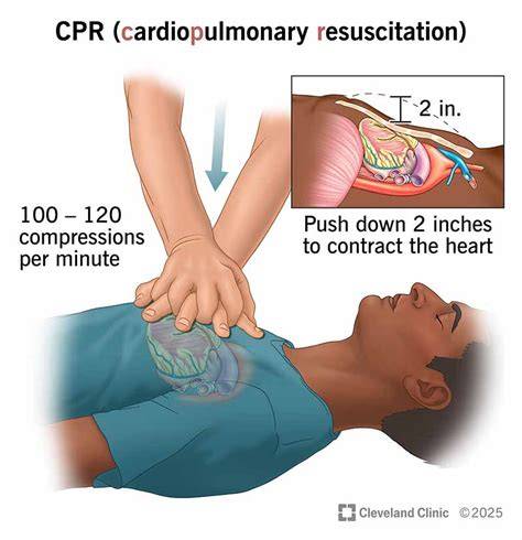 CPR compressions
