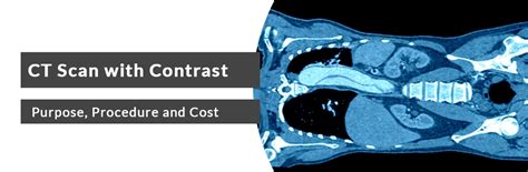CT scan image with contrast