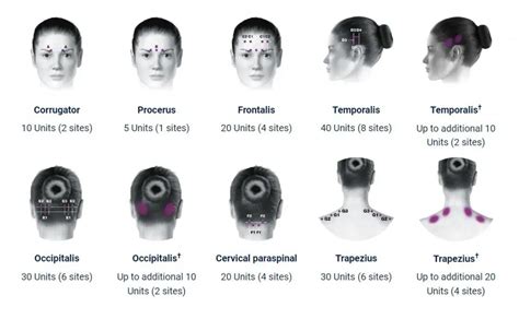 Can Botox cause neurological problems