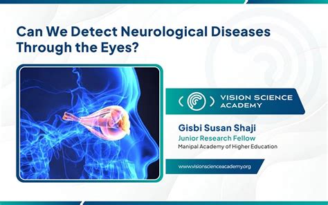 Can an eye exam detect neurological problems