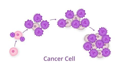 Cancer cells growing