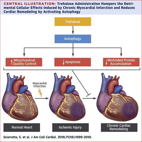 Remodeling Heart Failure