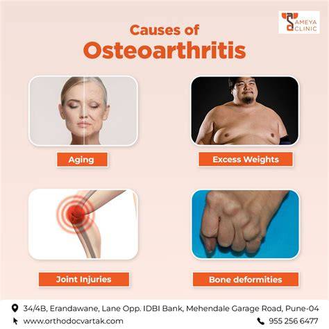 Causes of osteoarthritis