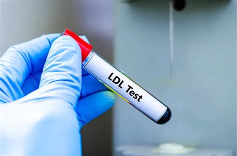 Cek dan Turunkan LDL