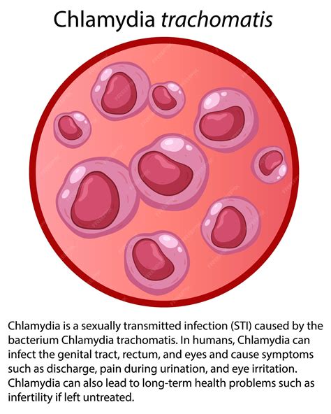 Chlamydia bacteria