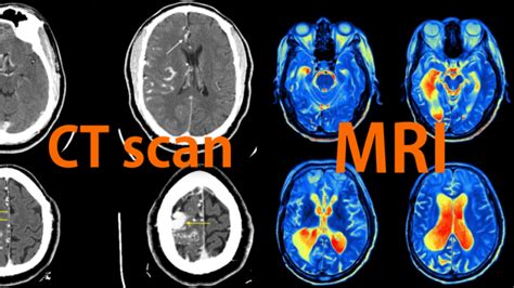 Contoh Non CT Scan