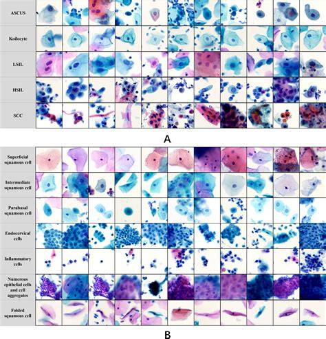 Cytopathology slide analysis