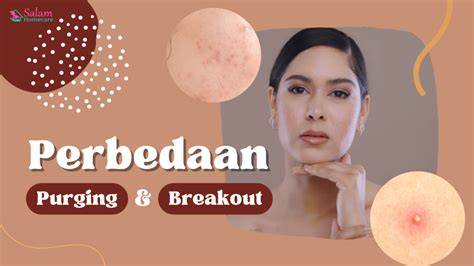 Dapat menyebabkan purging