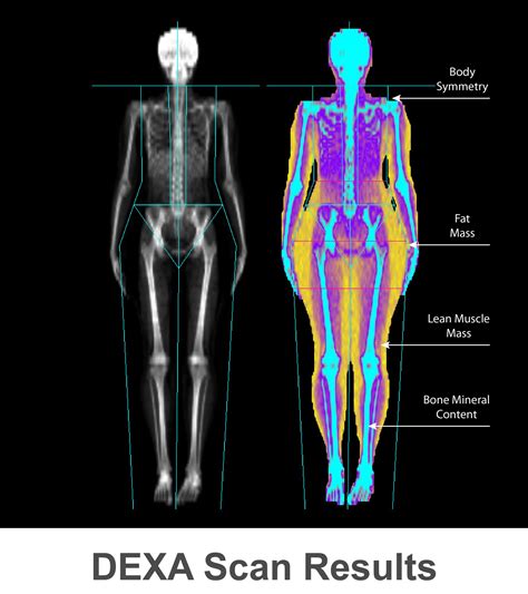 Body Scan Results