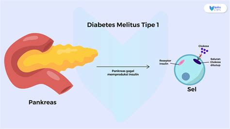 Diabetes Tipe 1