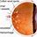 Diabetic Retinopathy Anatomy