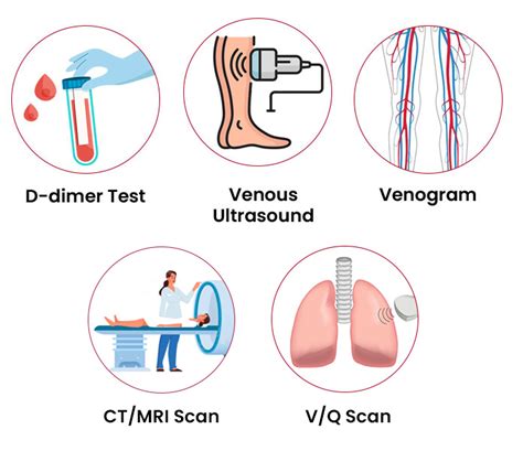 Diagnosis DVT