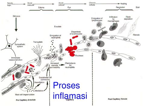 Diagram Proses Inflamasi Akut