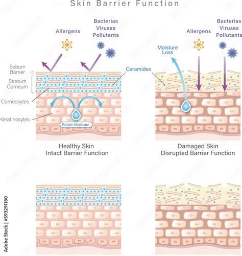 Diagram struktur skin barrier