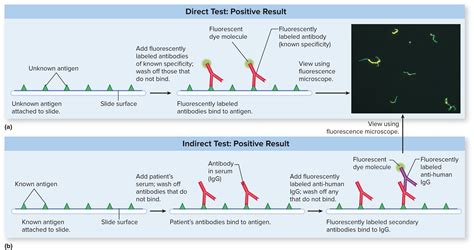 Direct Fluorescent Antibody Test