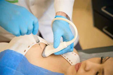 Doctor performing FNAB