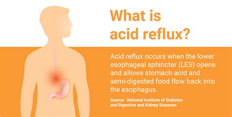 Does Catalog Work For Poeple With Acid Reflux