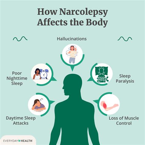 Does narcolepsy affect life expectancy
