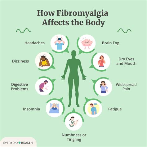 Does obesity cause fibromyalgia