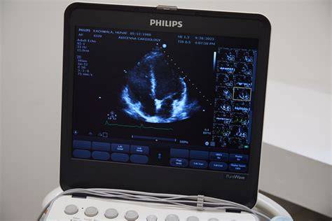 Doppler Ultrasound
