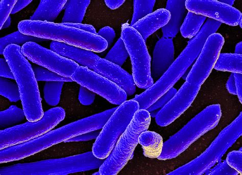 E. Coli