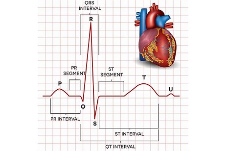 ECG heart activity