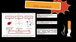 Efek Merokok pada HDL