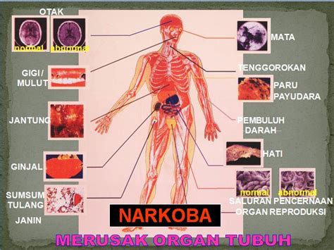 Efek Narkoba